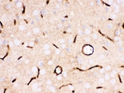 IHC testing of FFPE rat brain with SLC2A1 antibody. HIER: Boil the paraffin sections in pH 6, 10mM citrate buffer for 20 minutes and allow to cool prior to staining.