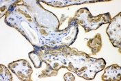 IHC testing of FFPE human placenta with SLC2A1 antibody. HIER: Boil the paraffin sections in pH 8 EDTA for 20 minutes and allow to cool prior to staining.