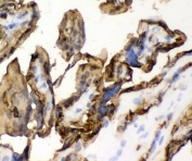 IHC testing of FFPE human placenta with SLC2A1 antibody. HIER: Boil the paraffin sections in pH 8 EDTA for 20 minutes and allow to cool prior to staining.