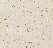 IHC testing of FFPE mouse brain with SLC2A1 antibody. HIER: Boil the paraffin sections in pH 8 EDTA for 20 minutes and allow to cool prior to staining.
