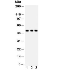 Western blot testing of 1) human PANC, 2) A549 and 3) HT1080 lysate with SLC2A2 antibody. Expected molecular weight: 57~70 kDa depending on glycosylation level, observed here at ~50 kDa.~