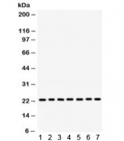 Western blot testing of 1) rat brain, 2) rat thymus, 3) rat lung, 4) mouse spleen, 5) mouse liver, 6) human HeLa, 7) human 22RV1 lysate with RALB antibody. Expected molecular weight ~23 kDa.