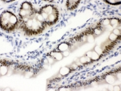 IHC testing of FFPE rat intestine with SLC22A2 antibody. HIER: Boil the paraffin sections in pH 6, 10mM citrate buffer for 20 minutes and allow to cool prior to staining.