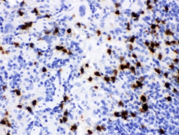 IHC testing of FFPE mouse spleen with Lipocalin 2 antibody. HIER: Boil the paraffin sections in pH 6, 10mM citrate buffer for 20 minutes and allow to cool prior to staining.