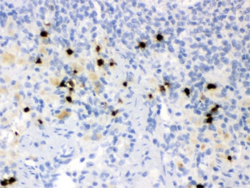 IHC testing of FFPE rat spleen with Lipocalin 2 antibody. HIER: Boil the paraffin sections in pH 6, 10mM citrate buffer for 20 minutes and allow to cool prior to staining.