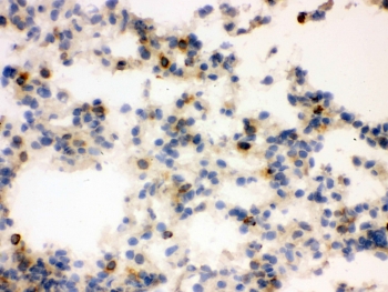 IHC testing of frozen rat lung tissue with Lipocalin 2 antibody.