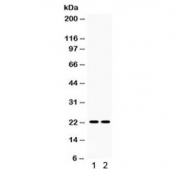 Western blot testing of 1) rat spleen and 2) rat lung lysate with Lipocalin 2 antibody. Predicted/observed molecular weight: 22-25 kDa.