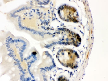 IHC testing of FFPE mouse intestine with Cdk4 antibody. HIER: Boil the paraffin sections in pH 6, 10mM citrate buffer for 20 minutes and allow to cool prior to staining.