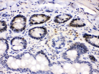IHC testing of FFPE rat intestine with Cdk4 antibody. HIER: Boil the paraffin sections in pH 6, 10mM citrate buffer for 20 minutes and allow to cool prior to staining.