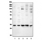 Western blot testing of 1) human HeLa, 2) human K562, 3) rat PC-12, 4) mouse NIH 3T3 and 5) mouse RAW264.7 cell lysate with Cdk4 antibody. Predicted molecular weight ~34 kDa.