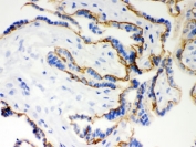 IHC testing of frozen human placenta with E-Cadherin antibody.