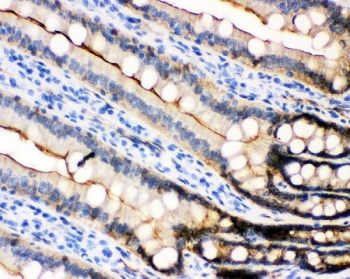 IHC testing of FFPE rat intestine with E-Cadherin antibody. HIER: Boil the paraffin sections in pH 6, 10mM citrate buffer for 20 minutes and allow to cool prior to staining.