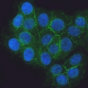 Immunofluorescent staining of FFPE human MCF7 cells with E-Cadherin antibody (green) and DAPI nuclear stain (blue). HIER: steam section in pH6 citrate buffer for 20 min.