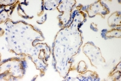 IHC testing of frozen human placenta with E-Cadherin antibody.
