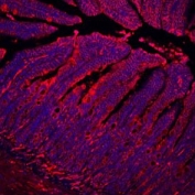 Immunofluorescent staining of FFPE mouse ileum with E-Cadherin antibody (red) and DAPI (blue). HIER: Boil the paraffin sections in pH 6, 10mM citrate buffer for 20 minutes and allow to cool prior to staining.