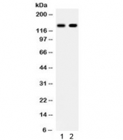 Western blot testing of 1) human placenta and 2) HeLa lysate with E-Cadherin antibody. Expected molecular weight: 135 kDa (precursor), 80-120 kDa (mature, depending on glycosylation level).