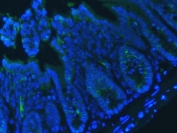 Immunofluorescent staining of FFPE mouse colon tissue with E-Cadherin antibody (green) and DAPI nuclear stain (blue). HIER: steam section in pH6 citrate buffer for 20 min.