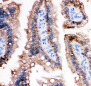 IHC testing of FFPE mouse intestine with E-Cadherin antibody. HIER: Boil the paraffin sections in pH 6, 10mM citrate buffer for 20 minutes and allow to cool prior to staining.