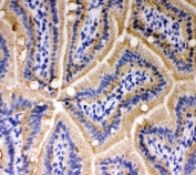 IHC testing of frozen mouse intestine with E-Cadherin antibody. 
