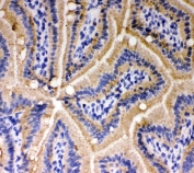 IHC testing of frozen mouse intestine with E-Cadherin antibody. 
