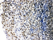 IHC testing of FFPE human tonsil with Ku70 antibody. HIER: Boil the paraffin sections in pH 6, 10mM citrate buffer for 20 minutes and allow to cool prior to staining.