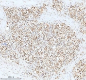 Immunofluorescent staining of FFPE human U-2 OS cells with Ku70 antibody (green) at 2ug/ml and DAPI nuclear stain (blue). HIER: steam section in pH6 citrate buffer for 20 min.