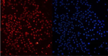 Immunofluorescent staining of FFPE human U-2 OS cells with Ku80 antibody (red) and DAPI nuclear stain (blue). HIER: Boil the paraffin sections in pH 6, 10mM citrate buffer for 20 minutes and allow to cool prior to staining.