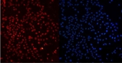 Immunofluorescent staining of FFPE human U-2 OS cells with Ku80 antibody (red) and DAPI nuclear stain (blue). HIER: Boil the paraffin sections in pH 6, 10mM citrate buffer for 20 minutes and allow to cool prior to staining.