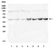 Western blot testing of 1) rat brain, 2) rat testis, 3) rat lung, 4) mouse brain, 5) mouse testis, 6) mouse lung and 7) mouse HEPA1-6 cell lysate with Ribonuclease Inhibitor antibody. Expected molecular weight ~50 kDa.