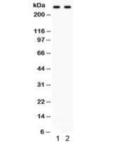 Western blot testing of 1) rat brain and 2) human HEPA lysate with Versican antibody. Predicted molecular weight: ~373/265/182/74/370 kDa (isoforms V0, V1, V2, V3 and Vint)