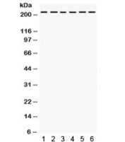 Western blot testing of 1) rat liver, 2) rat kidney, human 3) Jurkat, 4) 22RV1, 5) HepG2, 6) SMMC lysate with Integrin alpha 4 antibody. Predicted molecular weight ~115 kDa, routinely observed at ~150 kDa; observed here at ~220 kDa.