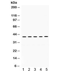 Western blot testing of human 1) A549, 2) HUT, 3) Jurkat, 4) SW620 and 5) MCF7 cell lysate with OSM antibody. Expected molecular weight ~28 kDa (precursor), ~24 kDa (pro form), ~28 kDa (glycosylated pro form); observed here at ~40 kDa.~