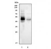 Western blot testing of human 1) A431 and 2) HaCaT cell lysate with Tissue Factor antibody. Expected molecular weight: 33-50 kDa depending on glycosylation level.