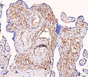 IHC staining of FFPE human placental tissue with Tissue Factor antibody. HIER: boil tissue sections in pH8 EDTA for 20 min and allow to cool before testing.