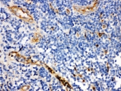 IHC testing of FFPE human tonsil with CD59 antibody. HIER: Boil the paraffin sections in pH 6, 10mM citrate buffer for 20 minutes and allow to cool prior to staining.