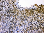 IHC testing of FFPE human tonsil with CD62L antibody. HIER: Boil the paraffin sections in pH 6, 10mM citrate buffer for 20 minutes and allow to cool prior to staining.