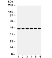 Western blot testing of 1) human placenta, 2) Jurkat, 3) CEM, 4) HL60, 5) rat spleen and 6) mouse spleen with CD62L antibody. Expected/observed molecular weight: 42~95 kDa depending on level of glycosylation.~