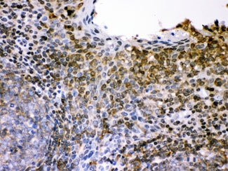IHC testing of FFPE human tonsil with
