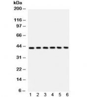 Western blot testing of 1) human placenta, 2) Jurkat, 3) CEM, 4) HL60, 5) rat spleen and 6) mouse spleen with CD62L antibody. Expected/observed molecular weight: 42~95 kDa depending on level of glycosylation.