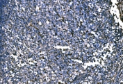 IHC staining of FFPE human tonsil tissue with PKM2 antibody. HIER: boil tissue sections in pH8 EDTA for 20 min and allow to cool before testing.