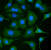 Immunofluorescent staining of FFPE human A549 cells with PKM2 antibody (green) and DAPI nuclear stain (blue). HIER: steam section in pH6 citrate buffer for 20 min.