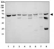Western blot testing of 1) human MCF7, 2) human MDA-MB-453, 3) human A549, 4) human U-87 MG, 5) rat brain, 6) rat L6, 7) mouse brain and 8) mouse NIH 3T3 cell lysate with PKM2 antibody. Expected molecular weight ~58 kDa.