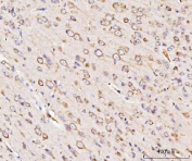 IHC staining of FFPE mouse brain with GRP94 antibody. HIER: boil tissue sections in pH8 EDTA for 20 min and allow to cool before testing.