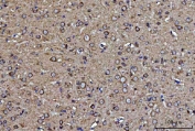 IHC staining of FFPE rat brain with GRP94 antibody. HIER: boil tissue sections in pH8 EDTA for 20 min and allow to cool before testing.