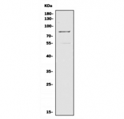 Western blot testing of human A549 cell lysate with MMP9 antibody. Predicted molecular weight: 92/67-80 kDa (precursor/mature forms).