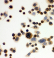 ICC staining of FFPE human SW480 cells with IDO1 antibody. HIER: Boil the paraffin sections in pH 6, 10mM citrate buffer for 20 minutes and allow to cool prior to staining.