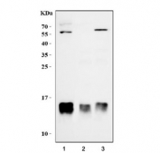 Western blot testing of 1) human RT4, 2) rat heart and 3) mouse heart lysate with FABP4 antibody. Expected molecular weight ~15 kDa.