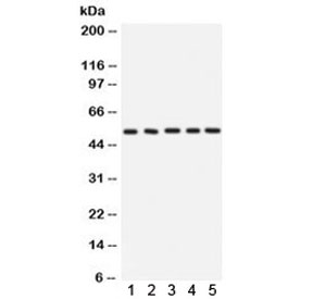Western blot testing of 1) rat testis, 2) rat pancreas, 3) rat skeletal muscle, 4) mouse kidney and 5) human MCF7 lysate with ARSA antibody. Expected/observed molecular weight ~54 kDa.