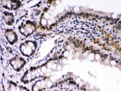 IHC testing of mouse intestine with c-Rel antibody. HIER: Boil the paraffin sections in pH 6, 10mM citrate buffer for 20 minutes and allow to cool prior to staining.