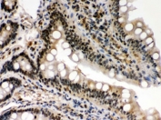 IHC testing of rat intestine with c-Rel antibody. HIER: Boil the paraffin sections in pH 6, 10mM citrate buffer for 20 minutes and allow to cool prior to staining.